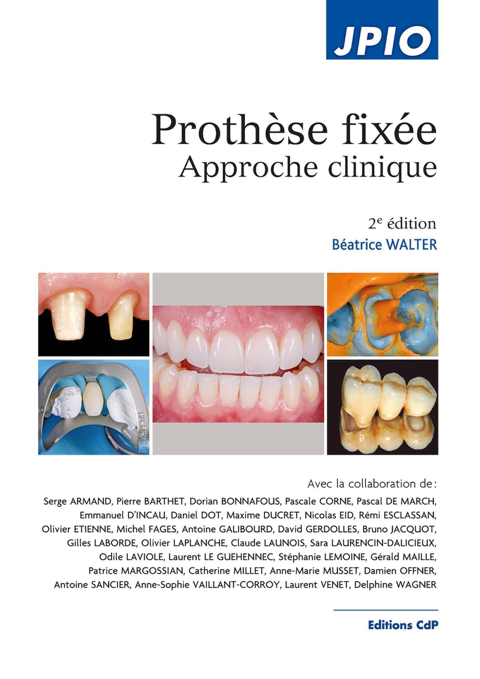 Prothèse fixée, 2e Ed. - Approche clinique (Relié)