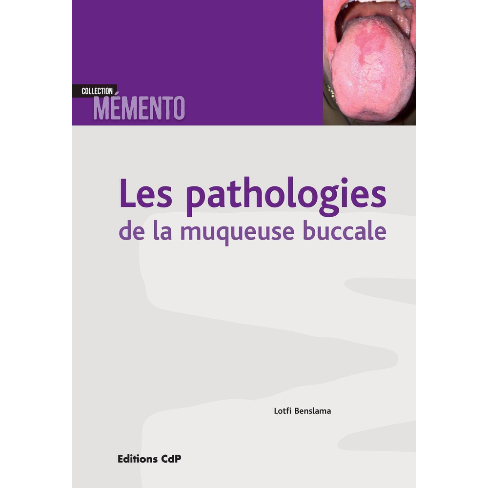 Les pathologies de la muqueuse buccale (Broché)